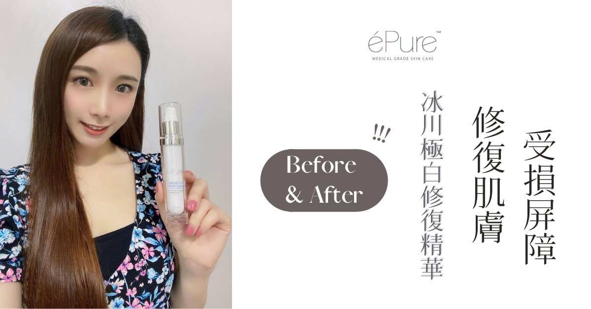 éPure 冰川極白修復精華︱修復肌膚受損屏障 - éPure